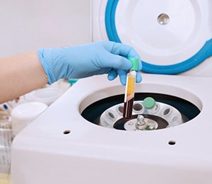 a person preparing a tube of blood in a centrifuge