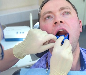 Man receiving fluoride from dentist in Hillsboro