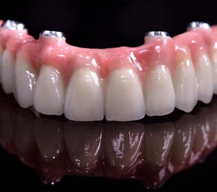 Implant denture for upper arch on reflective surface