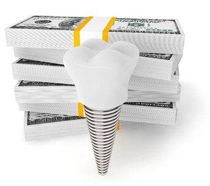A digital image of a stack of money and a dental implant standing in front of it