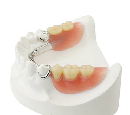 several types of dentures in Hillsboro on a white background