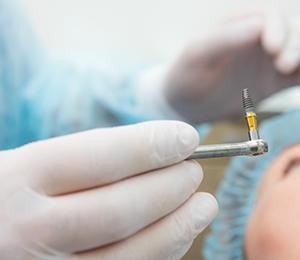 An up-close image of a dentist holding a dental implant in preparation for putting it in a patient’s mouth