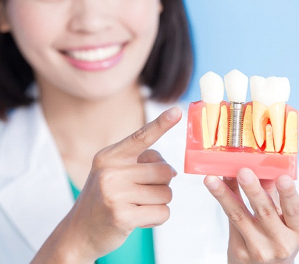 An oral surgeon in Hillsboro holding a mouth mold that contains a dental implant next to natural teeth