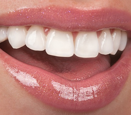 happy cosmetic dentistry patient