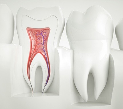 Animation of the inside of the tooth