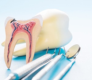 A broken tooth highlighting the cost of a root canal in San Antonio