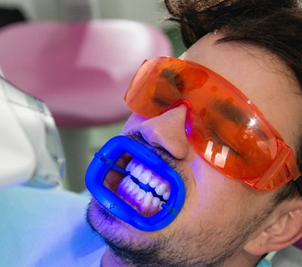 In-office teeth whitening