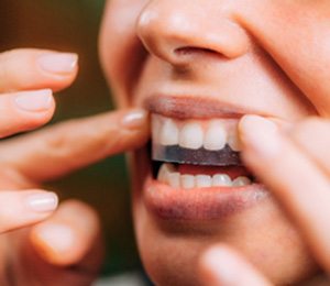 Woman placing teeth whitening strip on her top teeth